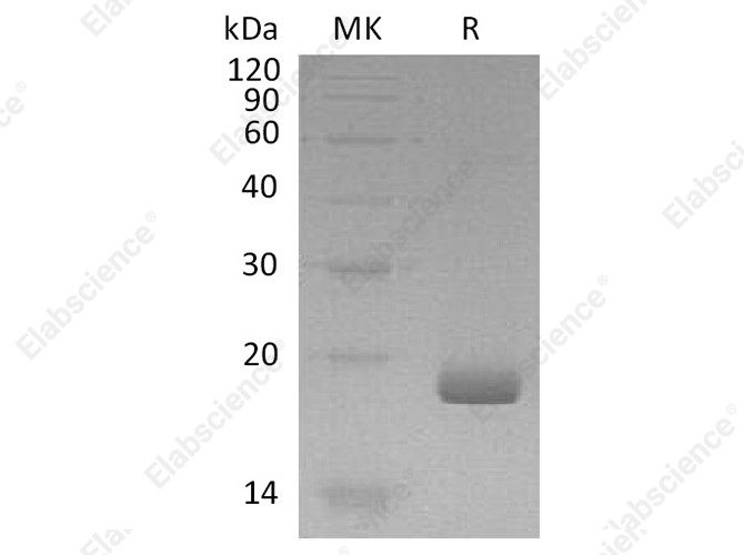 Recombinant Human IFN-λ3/IL-28B Protein - 1