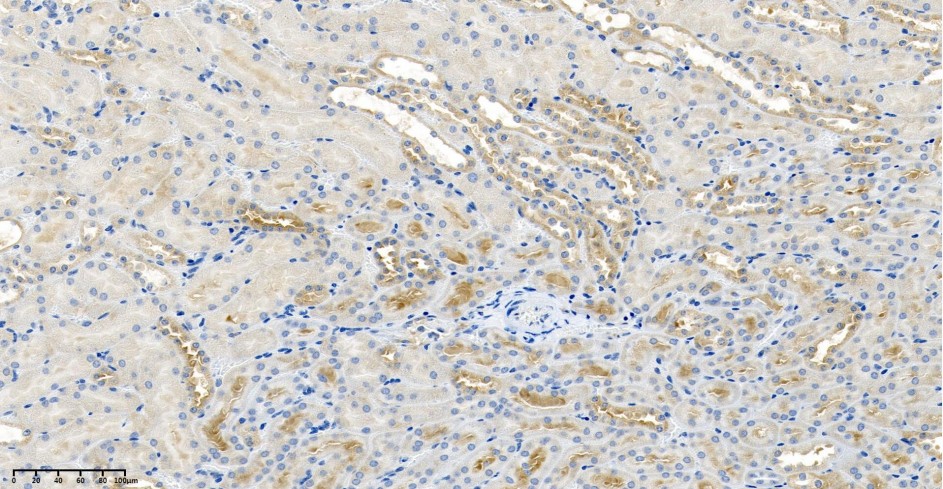 Recombinant Keap1 Monoclonal Antibody - small - 2