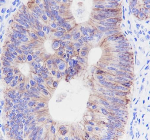 Recombinant Claudin-1 Monoclonal Antibody - small - 3