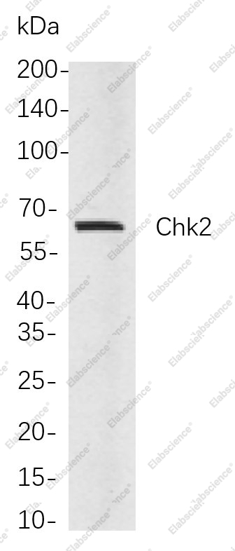 Recombinant Chk2 Monoclonal Antibody - 1