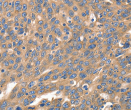 IRF1 Polyclonal Antibody - 3