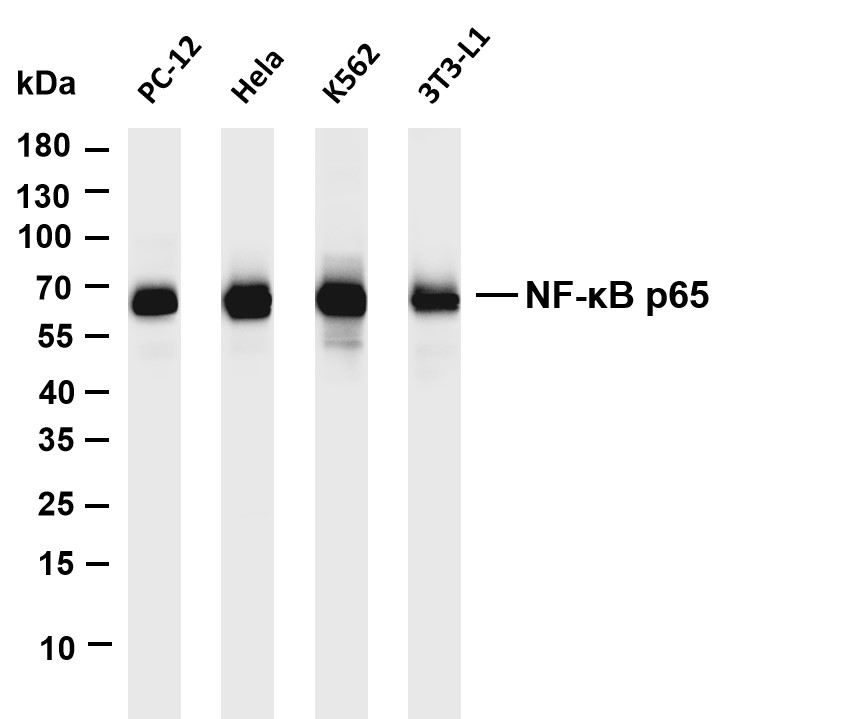 Recombinant NF-κB p65 Monoclonal Antibody - 3