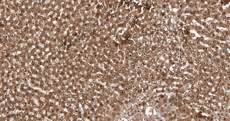 Recombinant Lactate Dehydrogenase Monoclonal Antibody - 3