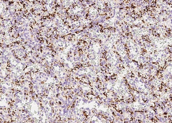 CD68 Monoclonal Antibody - small - 3