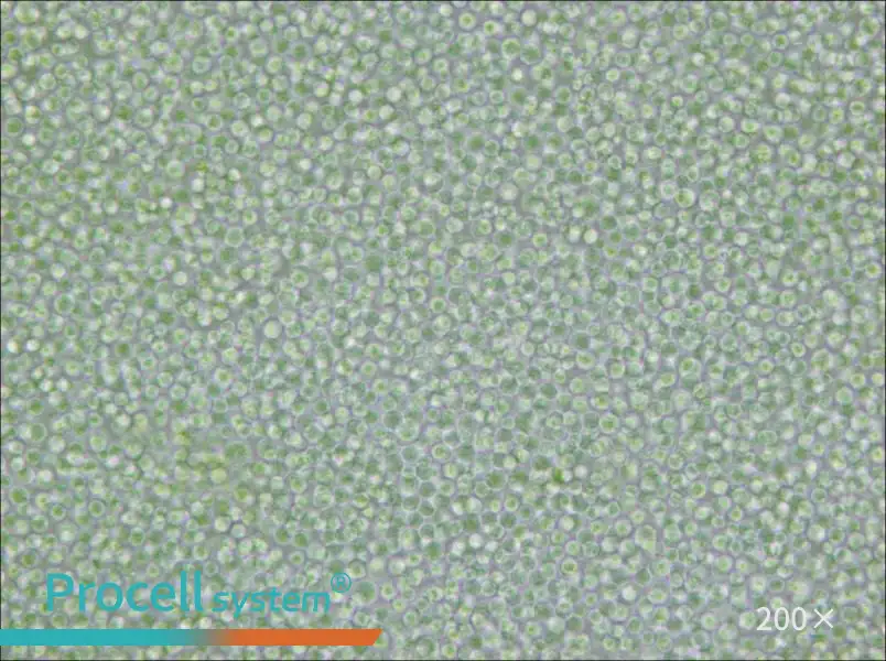 SU-DHL-4 Cell Complete Medium - 5