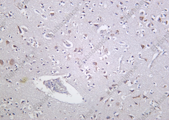 Recombinant PKD1 Monoclonal Antibody - 1