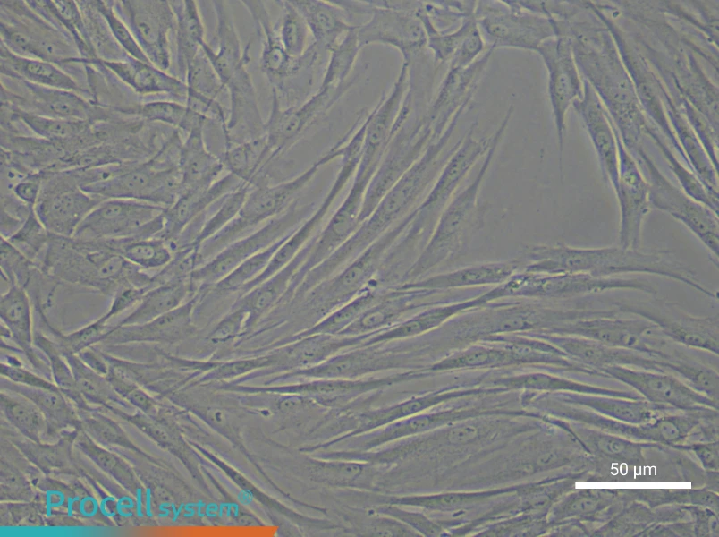 Human Endometrial Stromal Cell Complete Medium - 4