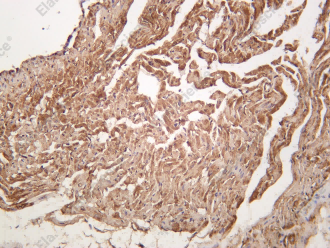 Recombinant PDE3A Monoclonal Antibody - 3