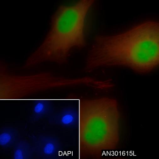 Recombinant CDKN2A/p14ARF Monoclonal Antibody - 3