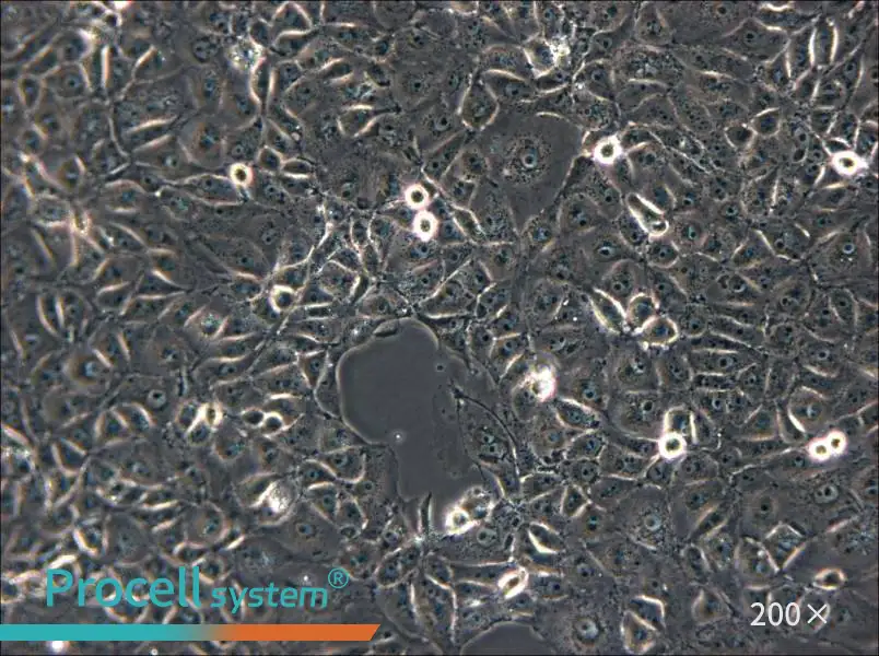 ST Cell Complete Medium - 6