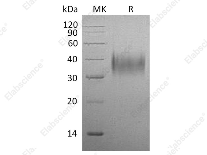 Recombinant Mouse CD16/FCGR3 Protein (His Tag) - 1