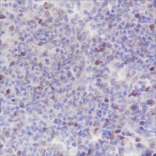 Recombinant Aurora B Monoclonal Antibody - 2