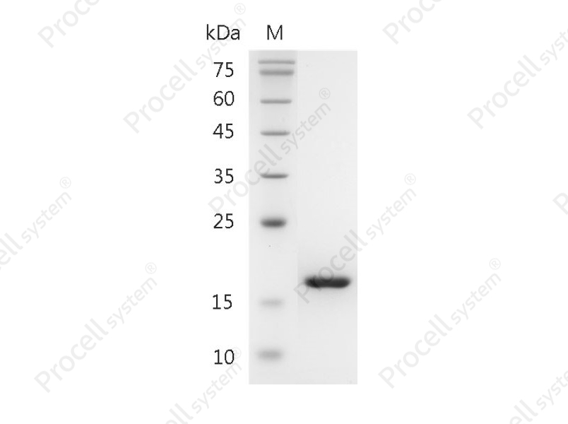 TNF-&alpha;/TNFA/TNFSF2, Mouse, Recombinant