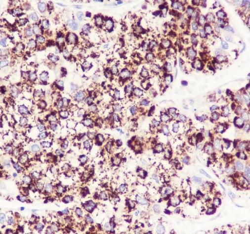 Recombinant CPS1 Monoclonal Antibody - 3