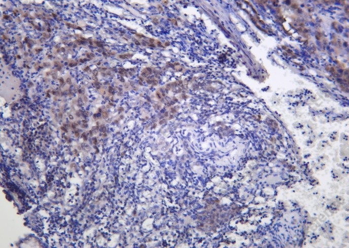 Recombinant FRA1 Monoclonal Antibody - 1
