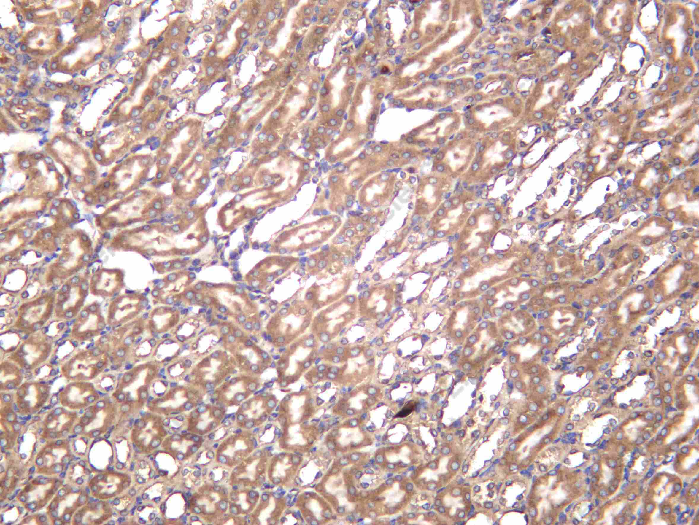 Recombinant KINH Monoclonal Antibody - 2