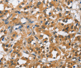 BCL10 Polyclonal Antibody - 2