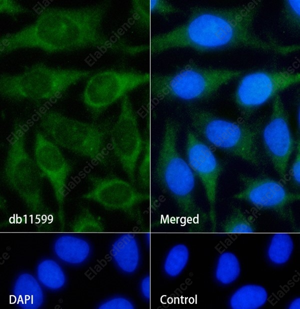 Recombinant 4E-BP1/EIF4EBP1 Monoclonal Antibody - 4