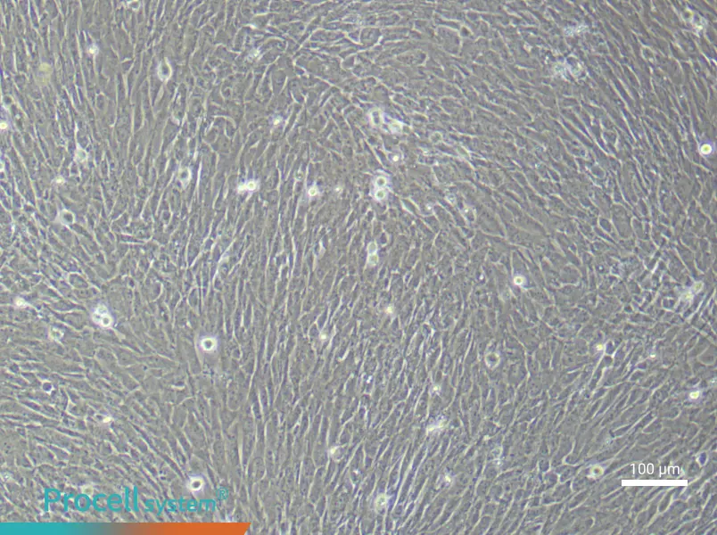 Human Ovarian Cancer Fibroblast (Primary cell immortalization) Complete Medium - 1