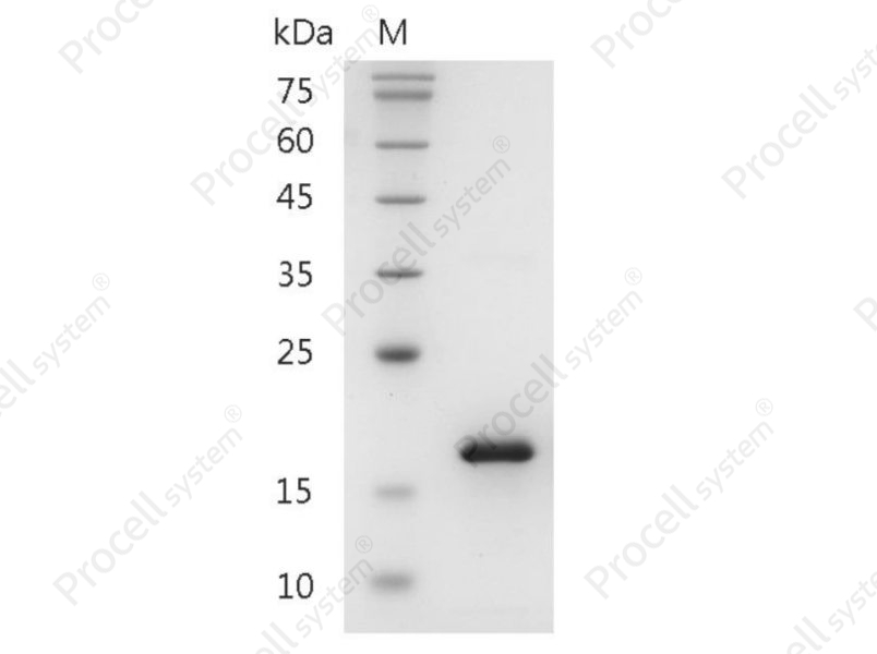 CCL2/MCP-1, Mouse, Recombinant - 1