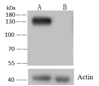 Recombinant N-Cadherin/CD325/CDH2 Monoclonal Antibody - small - 4