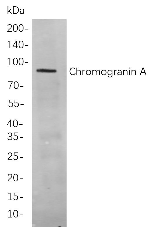Recombinant Chromogranin A Monoclonal Antibody-searchlist-1