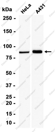 Recombinant DGKA Monoclonal Antibody - 1