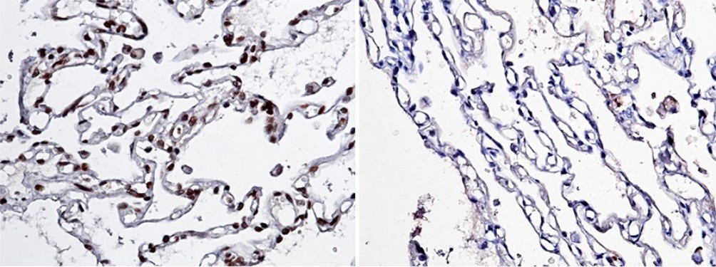 NBL1/DAND1/DAN Monoclonal Antibody - small - 1