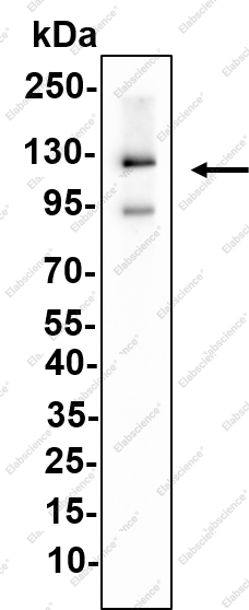 Recombinant E-cadherin Monoclonal Antibody - 2
