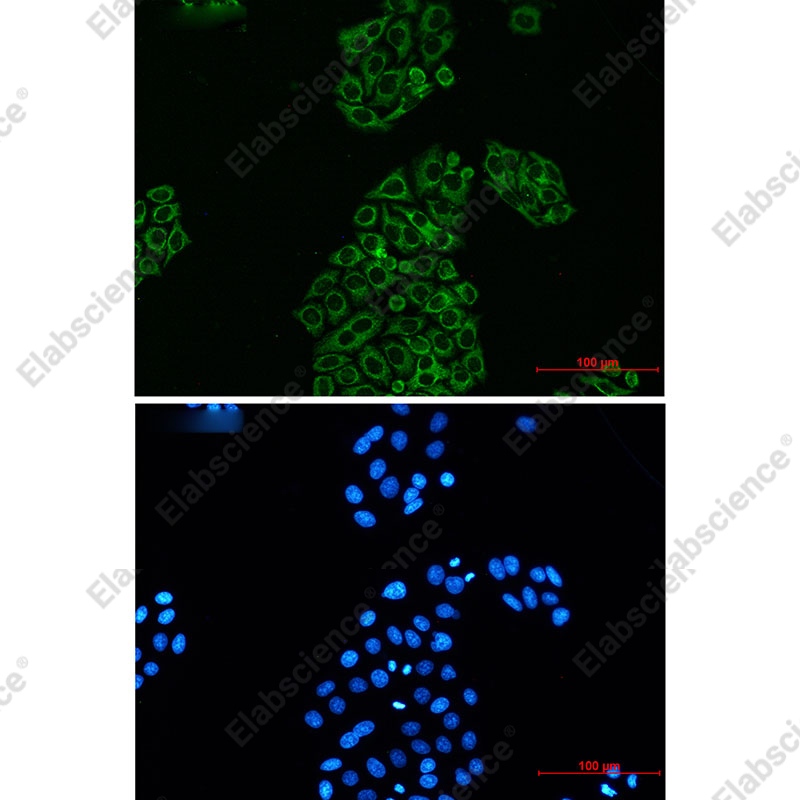Recombinant AK2/Adenylate kinase 2 Monoclonal Antibody - 4