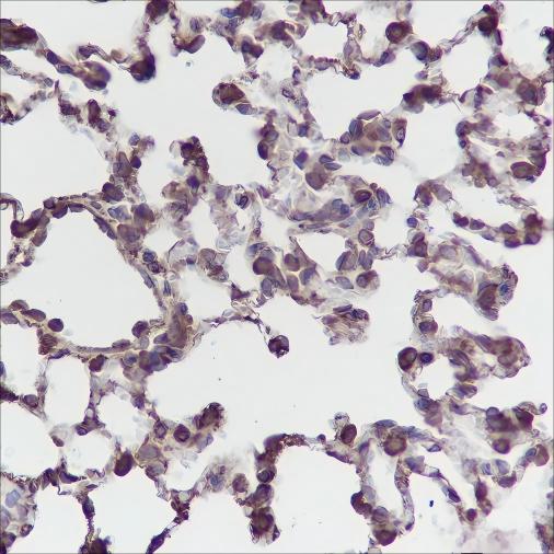 Recombinant PTGER2 Monoclonal Antibody - small - 4