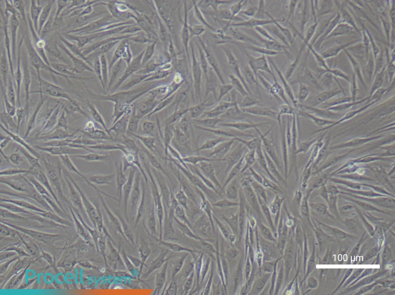 Human Synovial Fibroblast Complete Medium - 2