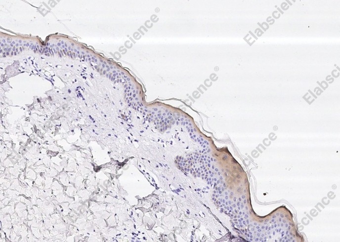 Cystatin A/CSTA Monoclonal Antibody - 2