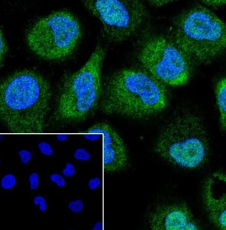 Recombinant CSNK2A1 Monoclonal Antibody - small - 4