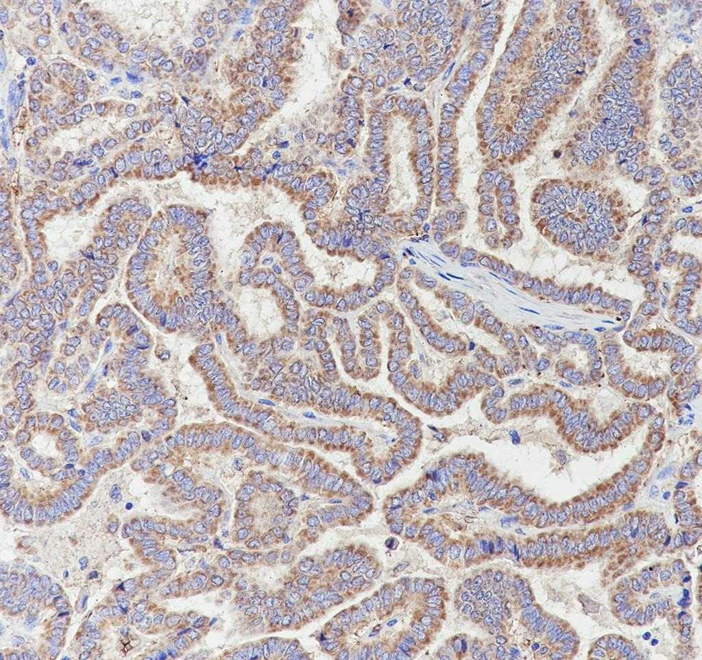 Recombinant SPR Monoclonal Antibody - small - 3