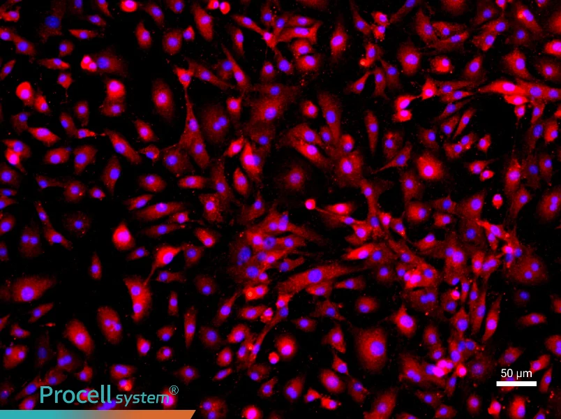 Mouse Pulmonary Microvascular Endothelial Cells - 1