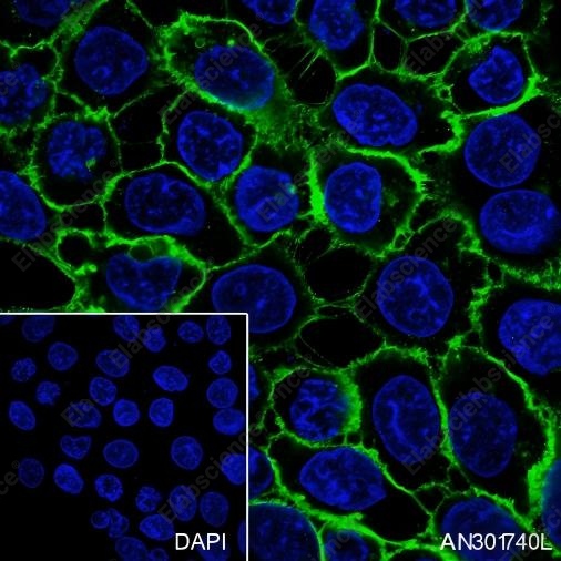 Recombinant Thrombomodulin Monoclonal Antibody - 2