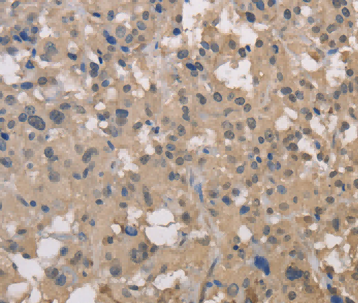 DRG1 Polyclonal Antibody - 2
