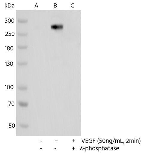 Recombinant Phospho-VEGF Receptor 2 (Tyr1175) Monoclonal Antibody - small - 2