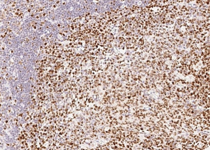 Recombinant MSH6/GTBP Monoclonal Antibody - small - 3