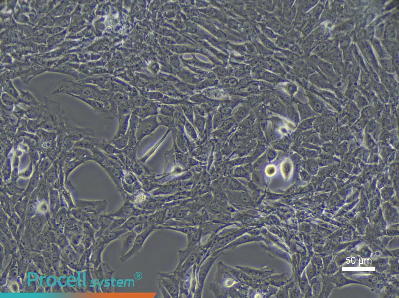 Rat Coronary Artery Smooth Muscle Cell Complete Medium - 6