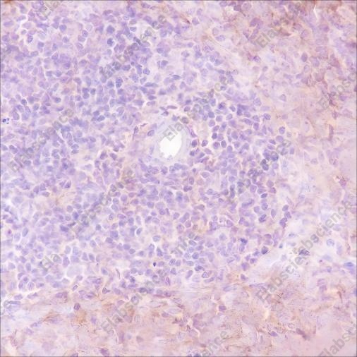 Recombinant VPAC2 Monoclonal Antibody - 3