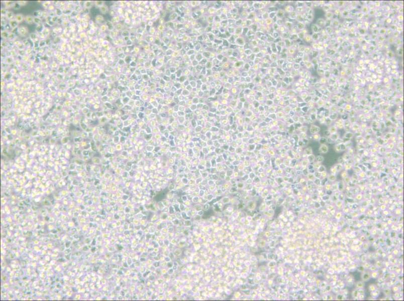 Reh Cell Complete Medium - small - 5