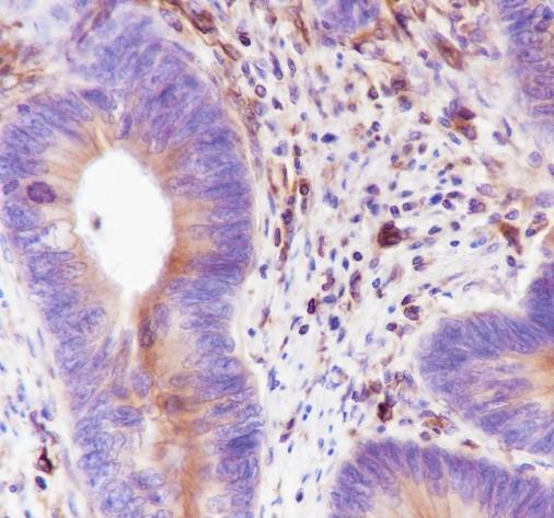 Recombinant STING Monoclonal Antibody - 3