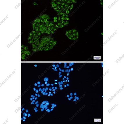 Recombinant Tec Monoclonal Antibody - 3