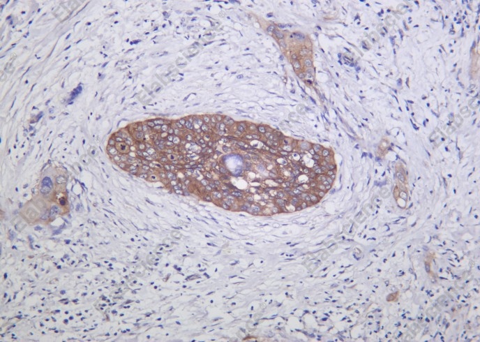 Recombinant Integrin α2 Monoclonal Antibody - 1