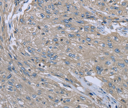 EZR Polyclonal Antibody - 3
