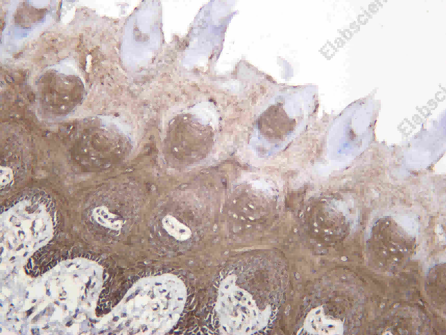 Recombinant TOMM70 Monoclonal Antibody - 4