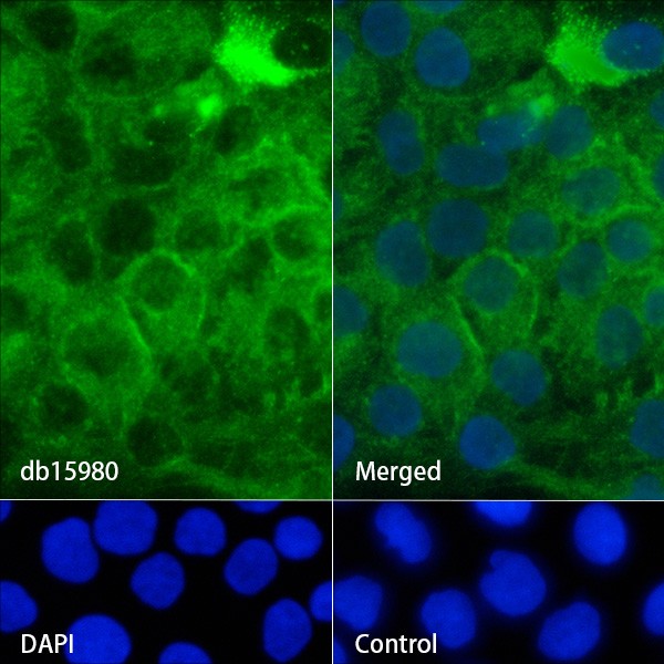 Recombinant Syndecan-1/SDC1 Monoclonal Antibody - 2