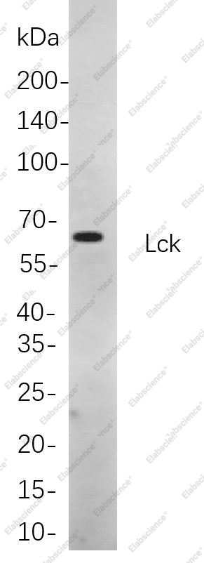Recombinant Lck Monoclonal Antibody - 1